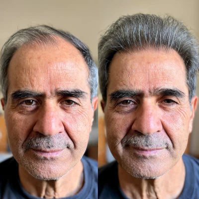 Stronger, Fuller Hair & Stronger Follicles