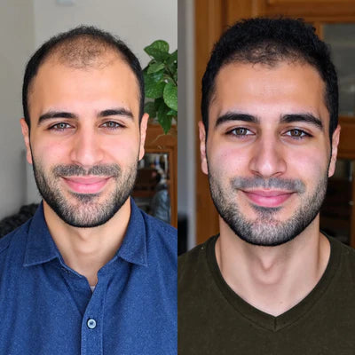 Confidence Restored & Looking Younger